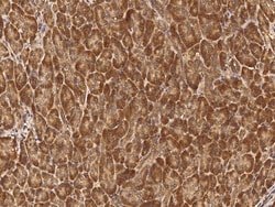 Sino Biological MCTS1 / Malignant T cell amplified sequence 1 Antibody,