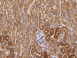 Sino Biological Mouse CTSB MAb 100ul (Sino Biological), Quantity: Each