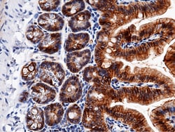 Sino Biological EpCAM / TROP-1 / TACSTD1 Antibody, Rabbit MAb 100µL, Quantity:
