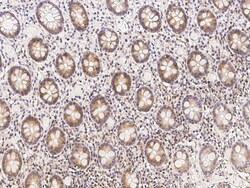 Sino Biological Anti-methionyl aminopeptidase 2/METAP2 Antibody, Rabbit