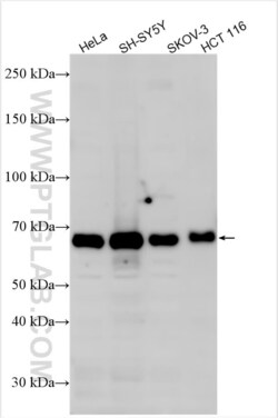 MEX3A Rabbit, anti-Human, Polyclonal, Proteintech Quantity: 150 &mu;L:Antibodies