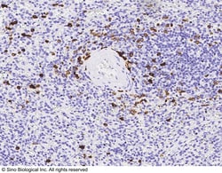 Sino Biological PERP1 / MZB1 Antibody, Rabbit MAb 100uL, Quantity: Each