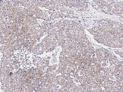 Sino Biological Anti-MART-1/MLANA Antibody, Rabbit Polyclonal, Quantity: