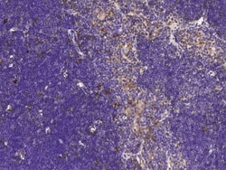 Sino Biological Anti-LY75/CD205 Antibody, Rabbit Polyclonal, Quantity: