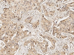 Sino Biological Anti-MMP13 Antibody, Rabbit Polyclonal, Quantity: Each
