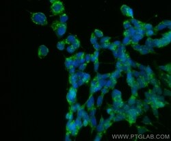 MMP19 Rabbit, anti-Human, CoraLite Plus 488, Polyclonal, Proteintech:Antibodies:Primary