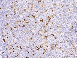 Sino Biological Anti-MMP-9 Antibody, Rabbit Polyclonal, Quantity: Each