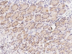 Sino Biological Anti-RON/MSP receptor Antibody, Rabbit Polyclonal, Quantity: