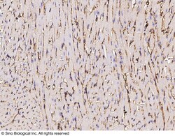 Sino Biological Anti-CD31/PECAM-1 Antibody, Rabbit Polyclonal, Quantity: