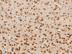 Sino Biological Anti-GPR44/CD294/PTGDR2 Antibody, Rabbit Polyclonal, Quantity: