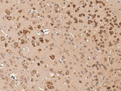 Sino Biological DEP1 / PTPRJ Antibody, Rabbit PAb, Antigen Affinity Purified