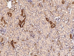 Sino Biological Anti-RARB Antibody, Rabbit Polyclonal, Quantity: Each of