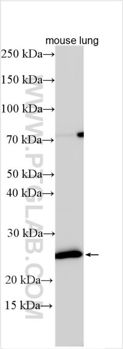 MS4A2 Rabbit, anti-Human, Polyclonal, Proteintech Quantity: 150 &mu;L:Anticorps