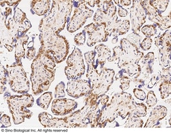 Sino Biological Anti-MSI2 Antibody, Rabbit Polyclonal, Quantity: Each of