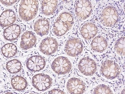 Sino Biological MSRA/Methionine Mulfoxide Reductase A Antibody, Rabbit