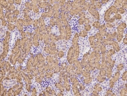 Sino Biological Transferrin Receptor / TFRC Antibody, Rabbit MAb 100µL,
