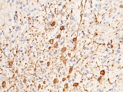 Sino Biological Anti-Tyrosine Hydroxylase Antibody, Rabbit Polyclonal,