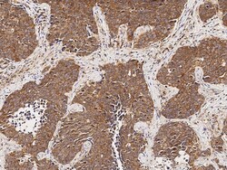 Sino Biological Anti-MTHFD1 Antibody, Rabbit Polyclonal, Quantity: Each