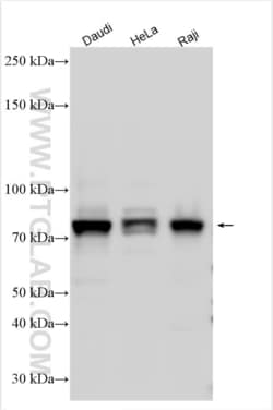 MTHFR Rabbit, anti-Human, Polyclonal, Proteintech Quantity: 150 &mu;L:Antibodies