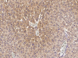 Sino Biological Anti-TREM-1 Antibody, Rabbit Polyclonal, Quantity: Each