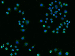 Sino Biological Recombinant Anti-TREM-2 Antibody, Rabbit Monoclonal, Quantity: