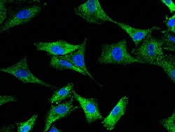 Sino Biological Anti-MVP Antibody, Rabbit Polyclonal, Quantity: Each of