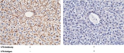 Sino Biological Vitronectin / VTN Antibody, Rabbit PAb, Antigen Affinity