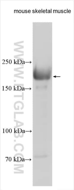MYH15 Rabbit, anti-Human, Polyclonal, Proteintech Quantity: 150 &mu;L:Antibodies