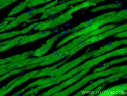 MYH6 Rabbit, anti-Human, CoraLite Plus 488, Polyclonal, Proteintech:Antibodies:Primary