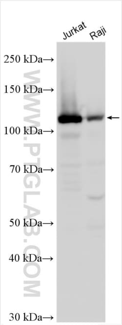 MYO1G Rabbit, anti-Human, Polyclonal, Proteintech Quantity: 150 &mu;L:Antibodies