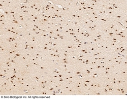 Sino Biological Anti-MYT1 Antibody, Rabbit Polyclonal, Quantity: Each of