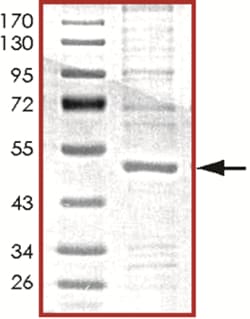 Sino Biological&nbsp;Recombinant Human Nck1 Protein (Full Length, His Tag)