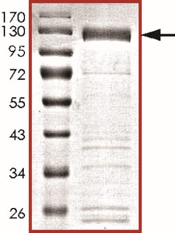 Sino Biological&nbsp;Recombinant Human NFAT2/NFATC1 Protein (Full Length, GST Tag)