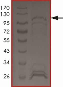 Sino Biological&nbsp;Recombinant Human NUAK2 Protein (Full Length, K81R, GST Tag)