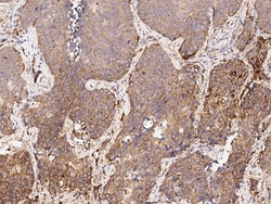 Sino Biological Anti-Napsin A Antibody, Rabbit Polyclonal, Quantity: Each