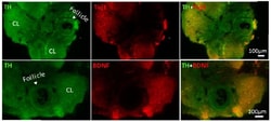 Abcam Rabbit polyclonal to beta III Tubulin - Neuronal Marker, Quantity: