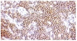Abcam Mouse monoclonal [FN-18] to CD3, Quantity: Each of 1