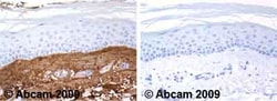 Abcam Rabbit polyclonal to Collagen III, Quantity: Each of 1