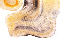 Fd Neurotechnologies Inc&nbsp;FD NeuroSilver&trade; Kit II (large)