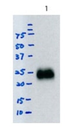 Abcam Mouse monoclonal [SB62a] Anti-Rabbit IgG light chain (HRP), Quantity: