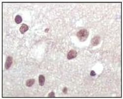 Abcam Mouse monoclonal [2D9A12] to CDKN2A/p16INK4a, Quantity: Each of 1