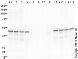 Abcam Rabbit polyclonal to PDHA1 (phospho S293), Quantity: Each of 1