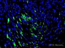 Abcam Mouse monoclonal [1C51] to mCherry, Quantity: Each of 1
