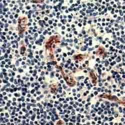 Abcam Mouse monoclonal [JC/70A] to CD31, Quantity: Each of 1