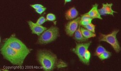 Abcam Rabbit polyclonal to Cytokeratin 5 - Cytoskeleton Marker, Quantity: