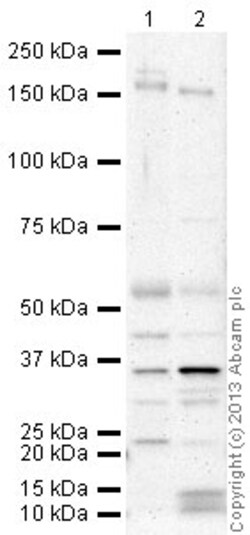 Abcam Rabbit polyclonal to CD163, Quantity: Each of 1