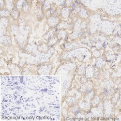 Abcam Mouse monoclonal [EGFR1] to EGFR, Quantity: Each of 1