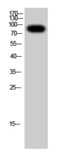 Abcam Rabbit polyclonal to Insulin Receptor (phospho Y1361), Quantity: