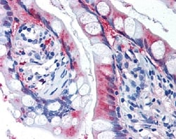 Abcam Rabbit polyclonal to xCT, Quantity: Each of 1