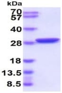 Abcam Recombinant A. victoria GFP protein, Quantity: Each of 1